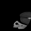 SPORK, NICO - 22.03.1976 - 02.08.2022 - CT obere Extremität - 17:51:17